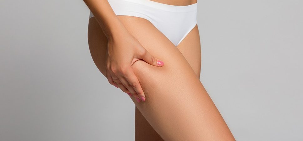Ending the Taboo on Cellulite with Acceptance